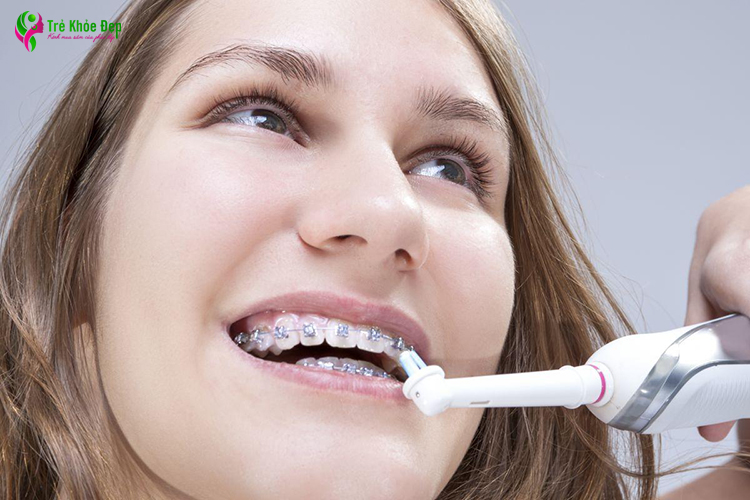 Bàn chải điện cho người niềng răng có khả năng làm sạch răng và mắc cài tối ưu hơn bàn chải bằng tay