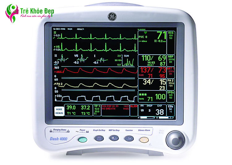 Các chỉ số thể hiện trên màn hình máy đo tim thai