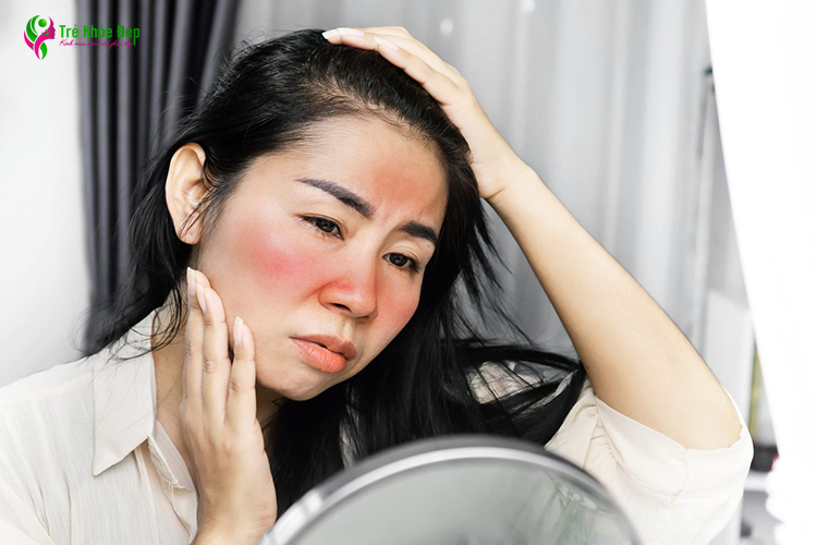 Cháy nắng là tình trạng da bị viêm, đau, đỏ và có cảm giác nóng khi chạm vào